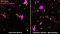 Bestimmte Immunzellen, die Mikroglia (gelb), beseitigen Amyloid-Plaques (magenta) im Gehirn einer Alzheimer-Maus (links). Degenerierendes Myelin lenkt sie davon ab (rechts).