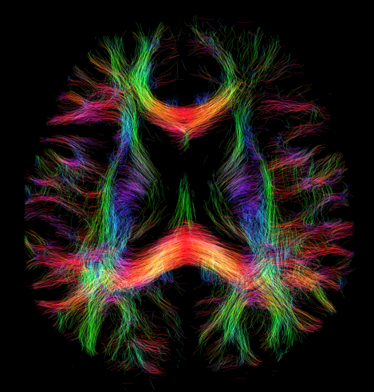 "Data courtesy of SFB1436 - project no. 425899996. Principal investigators: Prof. Dr. Oliver Speck, Jun.-Prof. Dr. Hendrik Mattern, Dr. David Berron. Acquisition and sequence design by Dr. Yi-Hang Tung. Visualization and processing by Dr. Daniel Uher. Scanner: Siemens MAGNETOM 7T Terra.X Impulse Edition, Department Biomedical Magnetic Resonance (BMMR), Otto-von-Guericke-Universität Magdeburg."