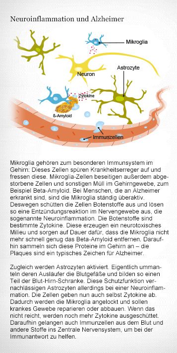 Besonderes Immunsystem fürs Gehirn: Die Neuroinflammation ist ein Mechanismus, wie Krankheitserreger im Hirn bekämpft werden – bei Alzheimer läuft es nicht ganz rund. Grafikerin: Meike Ufer