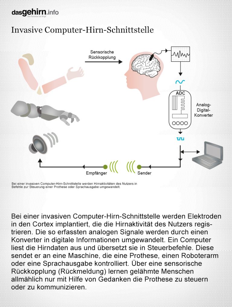 Steuerung von Prothesen mittels Computer-Hirn-Schnittstellen