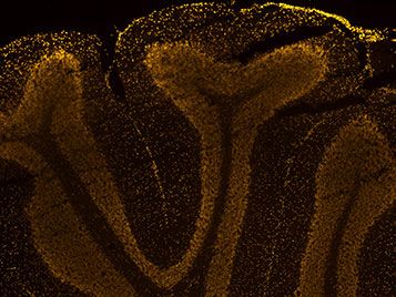 Querschnitt durchs Kleinhirn