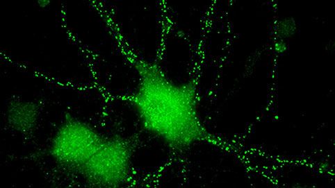 Kommunikation der Neuronen über Synapsenendknöpfe