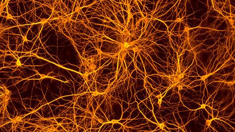 Hochverzweigtes Netzwerk der Neuronen