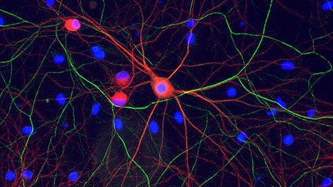 Neuronen und Gliazellen