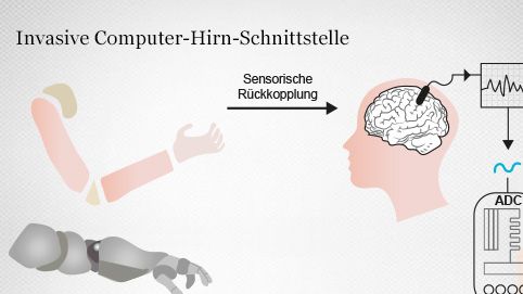 Steuerung von Prothesen mittels Computer-Hirn-Schnittstellen 