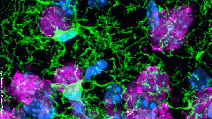 Mikroglia: Gesundheitswächter im Gehirn