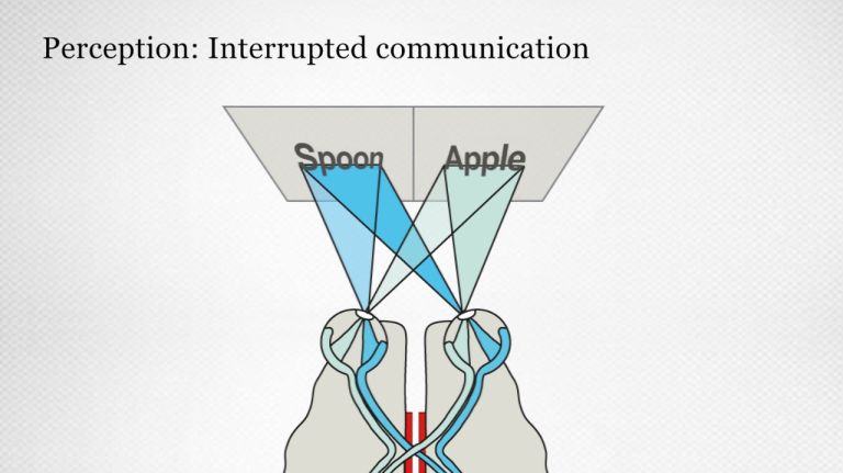 Cross-hemispheric processing of visual information