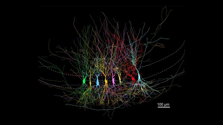 Collage von CA3-Pyramiden-Neuronen. Die mit Biocytin – einem Tracer, der sie während der Aufzeichnung markiert – gefüllten Neuronen werden fixiert und gefärbt, um eine vollständige Rekonstruktion ihrer Formen zu ermöglichen.