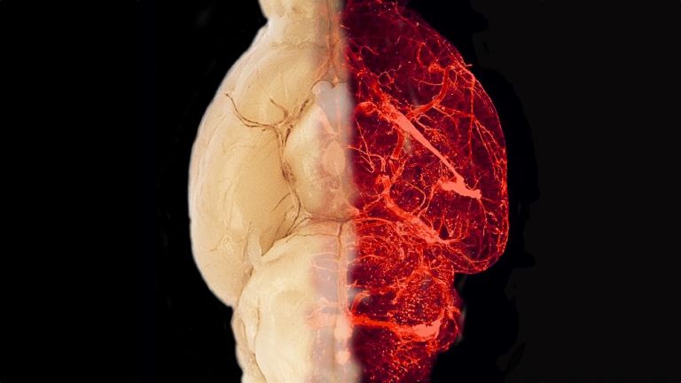 Blutgefäße im transparent erscheinenden Gehirn eines adipösen Mausmodells 