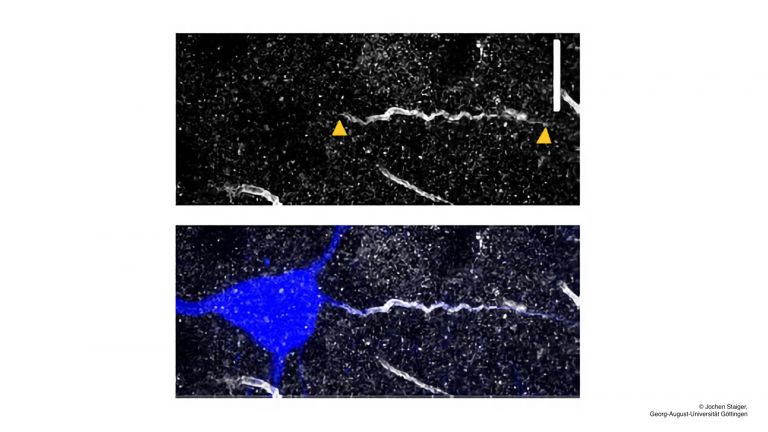 Mit Biocytin gefüllte Pyramidenzelle (blau) und ihr Axoninitialsegment (AIS; durch ßIV-Spectrin-Immuncytochemie angefärbt, grau). Maßstab: 10 µm. Nach elektrophysiologischer Charakterisierung wurden die dort gewonnen intrinsischen Membraneigenschaften mit der Länge des AIS korreliert.