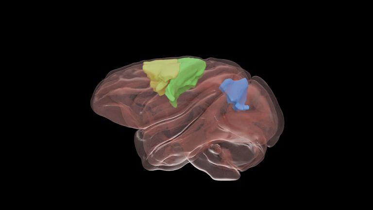 Graphic representation of a rhesus monkey brain. The areas of the brain that play a role in controlling arm and grasping movements are marked in color. Yellow: premotor cortex, green: motor cortex, blue: medial intraparietal area.