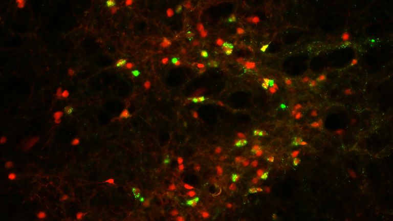 CRH-Neurone in der IPACL-Region produzieren ein rot fluoreszierendes Protein, das ihre Visualisierung erlaubt. Eine retrograde Markierung färbt CRH-Neurone zusätzlich grün, wenn sie mit der Substantia nigra im Mittelhirn verknüpft sind.