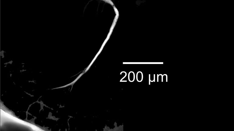 Mikroskopische Aufnahme der Mauthnerzelle eines Goldfisches (Maßstabbalken: 200 Mikrometer entsprechen 0,2 Millimeter). Durch Neurobiotin/Streptavidin-Cy3 wurde die Zelle sichtbar gemacht.