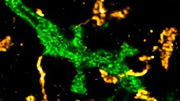 Einzelnes Fragment eines Neurons in grün und die in der Mitteilung erwähnten Astrozytenfortsätze in gelb. 