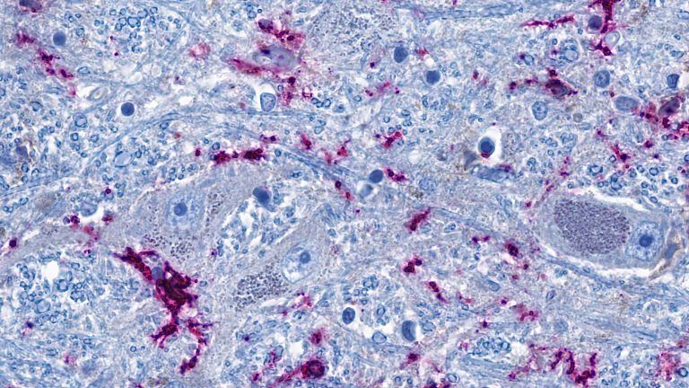 Ausschnitt aus dem Hirnstamm: Nervenzellen (graublau) stehen eng mit hirneigenen Immunzellen (lila) in Kontakt. Die blauen fadenförmigen Strukturen sind Fortsätze der Nervenzellen, die als Nervenfasern bis in weit entfernte Organe hineinreichen können. Der Studie zufolge können die Immunzellen und die Nervenzellen im Hirnstamm über die Nervenfasern durch die Entzündung in der Lunge direkt aktiviert werden. 