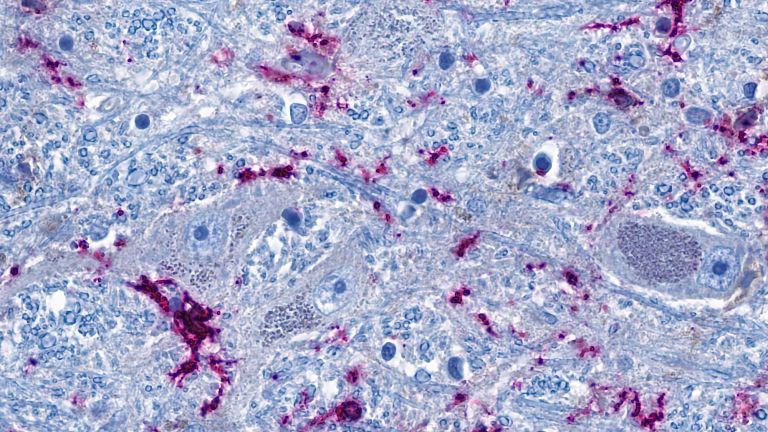 Ausschnitt aus dem Hirnstamm: Nervenzellen (graublau) stehen eng mit hirneigenen Immunzellen (lila) in Kontakt. Die blauen fadenförmigen Strukturen sind Fortsätze der Nervenzellen, die als Nervenfasern bis in weit entfernte Organe hineinreichen können. Der Studie zufolge können die Immunzellen und die Nervenzellen im Hirnstamm über die Nervenfasern durch die Entzündung in der Lunge direkt aktiviert werden. 