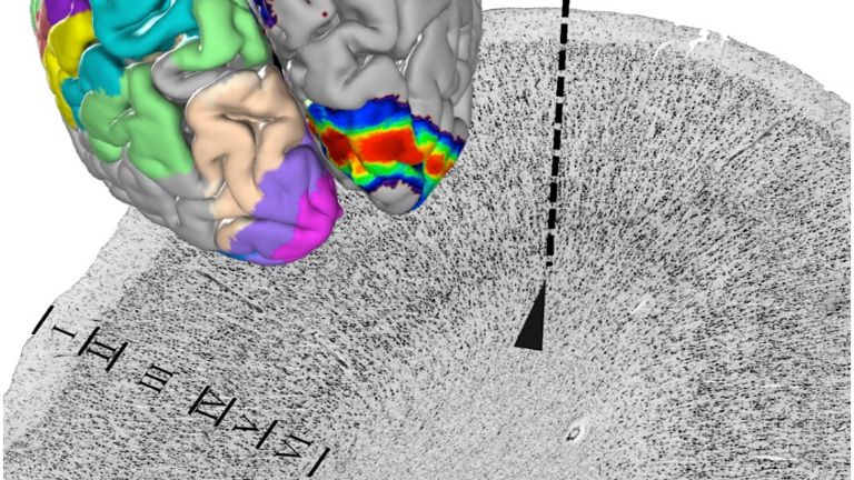 Die Architektur der Nervenzellen ändert sich an der Grenze zwischen zwei Arealen (gestrichelte Linie). Das ist die Grundlage der Kartierung.