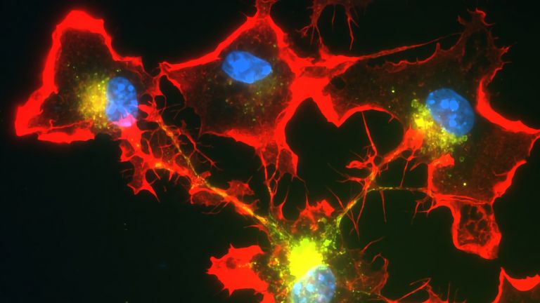 Mikroglia-Zellen - (blau: die Zellkerne) können sich durch schlauchartige Fortsätze (rot) zusammenschließen und so gefährliche Proteine in Arbeitsteilung abbauen.