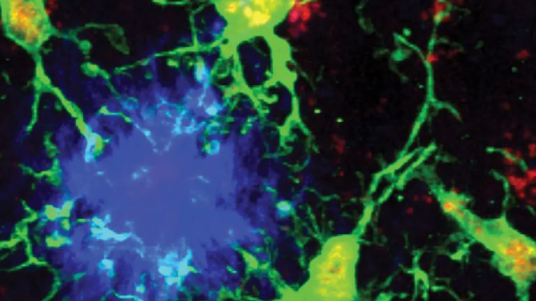 Mikroglia (grün) reagieren auf aggregierte Beta-Amyloid-Plaques (blau) im Kortex einer Maus.