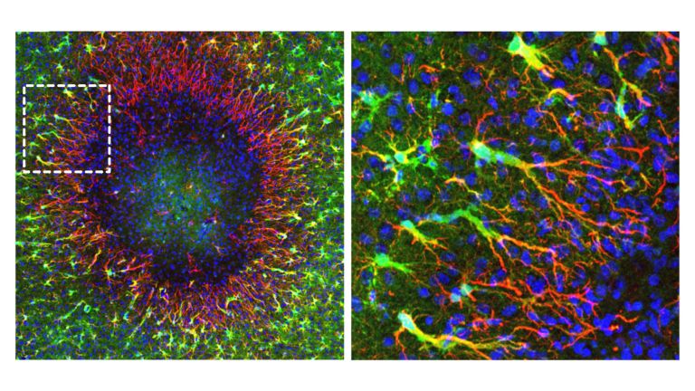 Die Abbildung links zeigt eine Hirnverletzung (Durchmesser: knapp 0,5 Millimeter). Am Rand der Läsion beginnen die neu entdeckten «regenerativen» Astrozyten, das defekte Gewebe zu reparieren. Sie bilden lange Zellfortsätze (rot) aus, entlang derer die neu gebildeten Zellkerne (blau) in Richtung der geschädigten Region wandern. Darum herum befinden sich unveränderte Astrozyten (grün). Die Abbildung rechts zeigt eine Vergrösserung des markierten Bereichs links. 