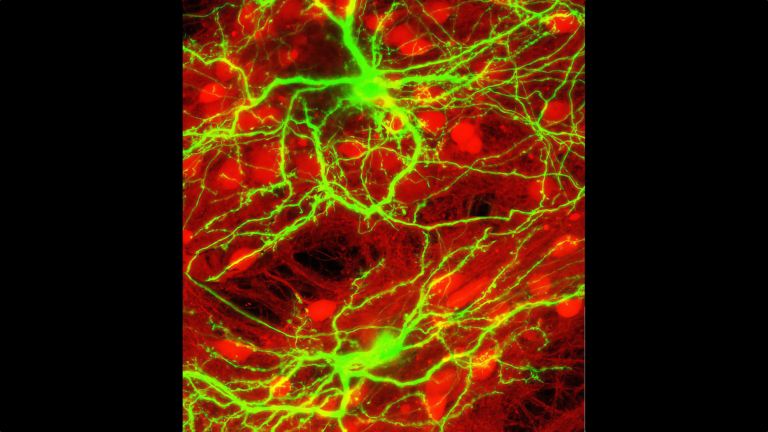 Neuronale Kultur mit 80 Prozent hemmenden (rot) and 20 Prozent erregenden (grün) Neuronen