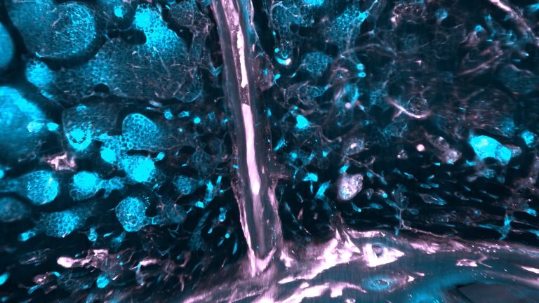 Myeloische Immunzellen (in Cyan) und Gefäße (in Pink). Die Knochenmarkshöhlen des Schädels sind von myeloischen Immunzellen besiedelt, während die Gefäße ein komplexes Netzwerk im gesamten Schädel bilden und die dynamische Natur dieser vitalen anatomischen Struktur zeigen.