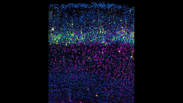 Auf den Spuren der Ursprünge kortikaler Neuronen. Gelb markiert sind Neuronen in der sich entwickelnden Großhirnrinde einer Maus, die durch Elektroporation im Mutterleib markiert wurden. Durch das Einbringen ausgewählter Gene in neurale Stammzellen vor der Geburt können Forscher:innen die aus diesen Vorläuferzellen entstehenden Neuronen verfolgen. Die Zellkerne sind blau dargestellt.