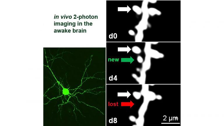 Chronisches 2-Photonen Imaging fluoreszenzmarkierter Nervenzellen in der Hirnrinde wacher Mäuse: während der ersten 4 Tage, von Tag 0 (d0) bis Tag 4 (d4), wurde eine dendritische Dorne neu gebildet (weiße Ausbuchtung, grüner Pfeil); nach spezifischer Reizung eines Auges in den nächsten 4 Tagen (bis d8), wurde die Dorne eliminiert (roter Pfeil). Der weiße Pfeil zeigt auf eine stabile Dorne.