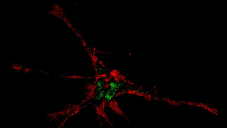 Magnetisch fanden die Nanopartikel ihren Weg in die Spitzen der Fortsätze von Nervenzellen. 