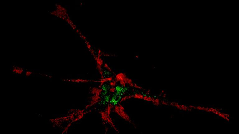 Magnetisch fanden die Nanopartikel ihren Weg in die Spitzen der Fortsätze von Nervenzellen. 