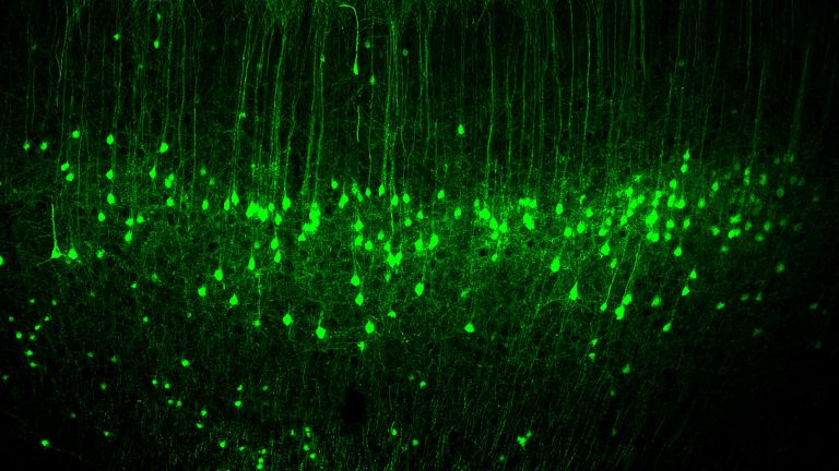 Neurone aus der Layer 5 des motorischen Kortex, die mit einem Fluoreszenzfarbstoff angefärbt wurden.