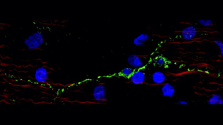 Ein einzelnes Schrittmacherneuron bei Hydra wird mit Hilfe von Antikörpern gegen Hydra-Schrittmacher-spezifische Ionenkanäle (in grün) sichtbar gemacht. Zellkerne sind blau dargestellt, Muskelfasern von Epithelzellen sind in Magenta gezeigt.