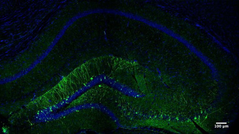 Die Abbildung zeigt den Teil des Hippocampus einer Maus, der beim Erlernen der neuen Aufgabe aktiviert wird. In grüner Farbe erscheinen die Neuronen, die die spezifische Erinnerung an diese Aufgabe codieren.