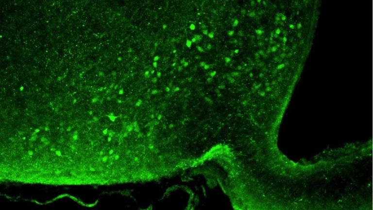 Nozizeptin-Neurone im Nucleus arcuatus des Hypothalamus